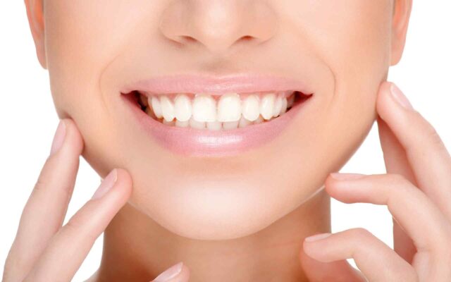 Dental Com sonrisa dientes blancos