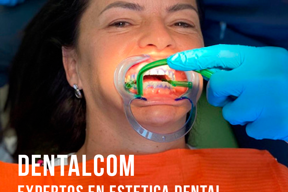 ¿Qué es la odontología estética y qué trata?